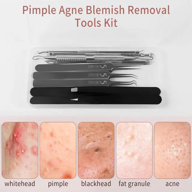 Alt view image 7 of 7 - Blackhead Remover Tools, 8 Pack Pimple Popper Tool Kit, 4 Pack Tweezers Set, Quickly and Easily Removes Acne and Blackheads, Precision Eyebrow Tweezers for Facial Hair