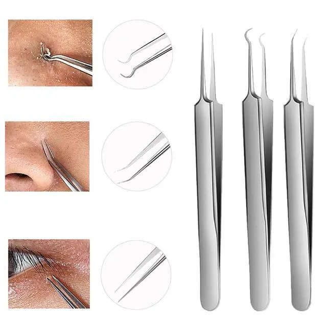Alt view image 2 of 6 - Blackhead Tweezers, Blackhead Extractor, Pimple Popper Tool Kit, 3 in 1 Professional Stainless Skin Zit Acne Blemish Whitehead Popping Removing Surgical Tools Set, Silver