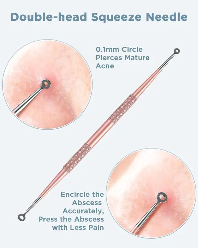 Alt view image 5 of 5 - Blackhead Remover Tool, Pimple Popper Tool Kit, Blackhead Extractor Tool for Face, Extractor Tool for Comedone Zit Acne Whitehead Blemish, Stainless Steel Extraction Tools
