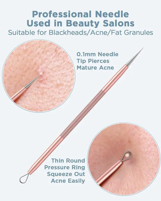Alt view image 4 of 5 - Blackhead Remover Tool, Pimple Popper Tool Kit, Blackhead Extractor Tool for Face, Extractor Tool for Comedone Zit Acne Whitehead Blemish, Stainless Steel Extraction Tools