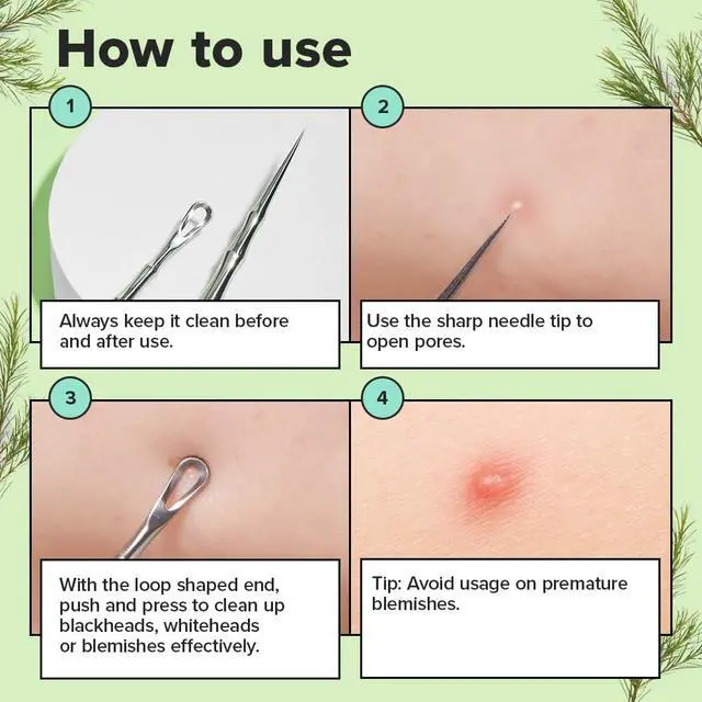 Alt view image 3 of 6 - Dual-Tip Pimple Tool - Proper Popper | Blackhead Remover, Blemish Exfoliating, Professional Acne Squeezer, Comedone Zit Extractor for Women, 2in1 Stainless Steel Lancet, 1ea