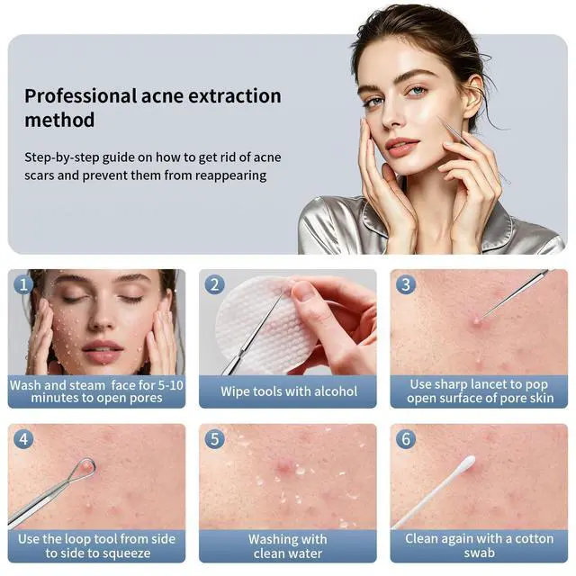 Alt view image 7 of 7 - Titanium Lancet Needle Acne Blackhead Remover Pimple Extractor Popper Tool