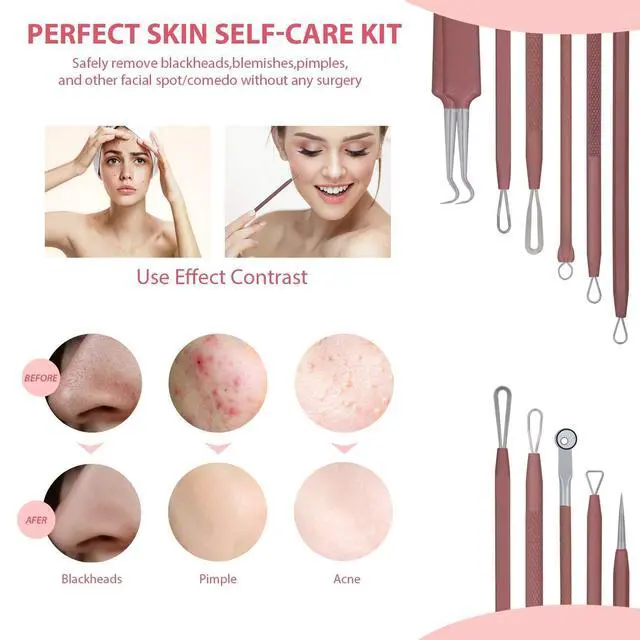 Alt view image 2 of 6 - Blackhead Remover Tool Comedones Extractor Acne Removal Kit for Blemish, Whitehead Popping, 6 Pcs Zit Removing for Nose Face Tools with a Leather Bag (Pink)