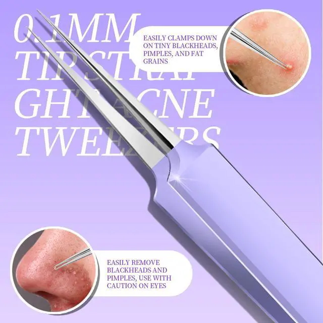 Alt view image 4 of 7 - Pimple Popper Tool Kit and Blackhead Remover Tools, Ingrown Hair Tweezers, Professional Blackhead Extractor Pimple Extractor Comedone Extractor