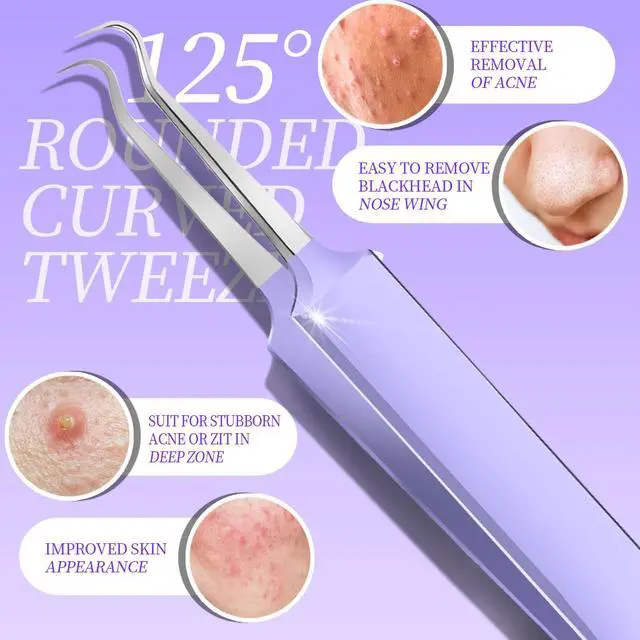 Alt view image 3 of 7 - Pimple Popper Tool Kit and Blackhead Remover Tools, Ingrown Hair Tweezers, Professional Blackhead Extractor Pimple Extractor Comedone Extractor