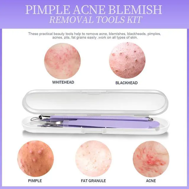 Alt view image 7 of 7 - Pimple Popper Tool Kit and Blackhead Remover Tools, Ingrown Hair Tweezers, Professional Blackhead Extractor Pimple Extractor Comedone Extractor