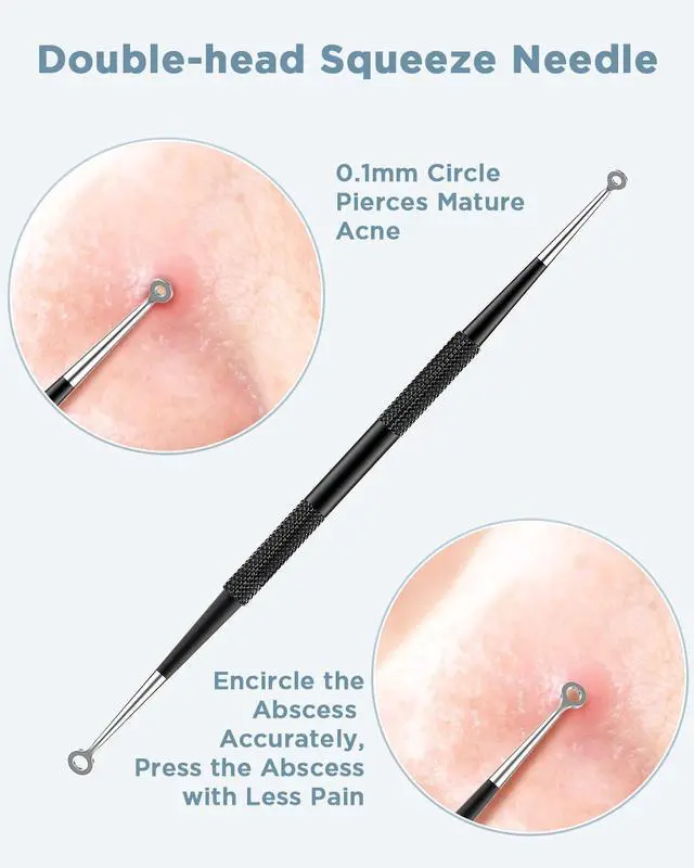 Alt view image 5 of 5 - Blackhead Remover Tool, Pimple Popper Tool Kit, Blackhead Extractor Tool for Face, Extractor Tool for Comedone Zit Acne Whitehead Blemish, Stainless Steel Extraction Tools