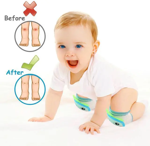 Alt view image 5 of 7 - Baby Knee Pads for Crawling, Anti-Slip and Protect Toddlers Knees. Knee Warmer and Breathable 3D Mesh for Boys and Girls, 3 6 12 Months Old Baby Must Haves (3 Pairs)