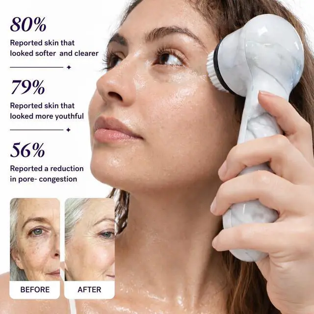 Alt view image 4 of 7 - Beauty Soniclear Allure 2026 Readers Choice Winner Sonic (no Rotating) Facial Cleansing + Exfoliation Brush for Men/Women, Antimicrobial Protected Bristles, 4 speeds, Serum Infusion Head