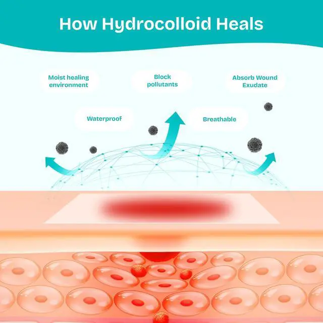 Alt view image 4 of 6 - Hydrocolloid Wound Care Roll, Waterproof 2in x 16.5ft, Extra Large Cut-to-Size Self-Adhesive Bandages for Blister, Scar, Pimple, First Aid Essential