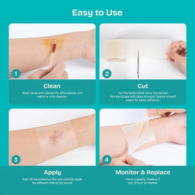 Alt view image 6 of 6 - Hydrocolloid Wound Care Roll, Waterproof 2in x 16.5ft, Extra Large Cut-to-Size Self-Adhesive Bandages for Blister, Scar, Pimple, First Aid Essential