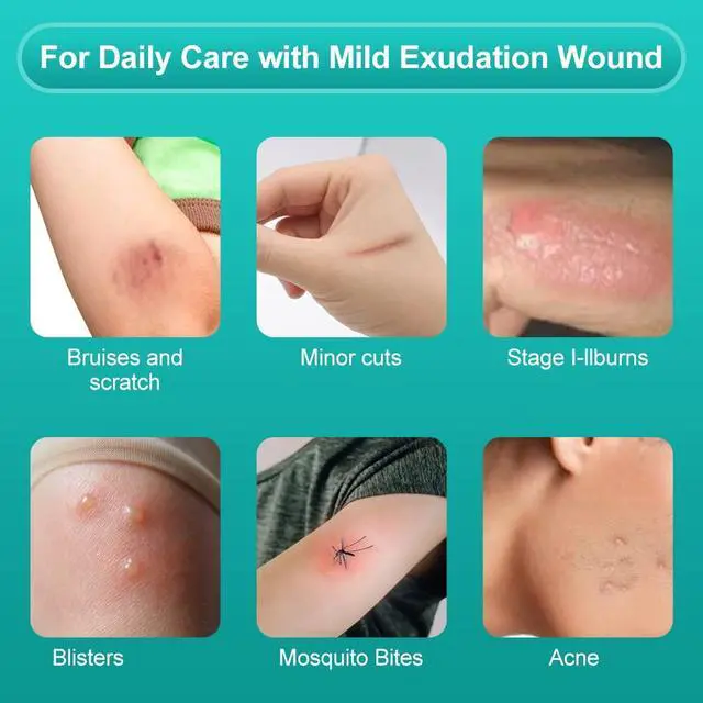 Alt view image 7 of 7 - Hydrocolloid Wound Dressing, 10 Pcs Ultra Thin 4" x 4" Large Patch Bandages with Self-Adhesive, Fast Healing for Bedsore, Burn, Blister, Acne Care, Sterile and Waterproof