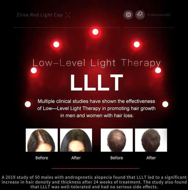 Alt view image 3 of 7 - Laser hair cap 128, red light hair growth cap 650nm, thinning hair device men women