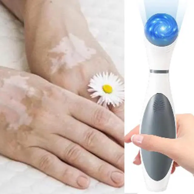 Alt view image 2 of 2 - 308nm LED Light Device for Small Area Care