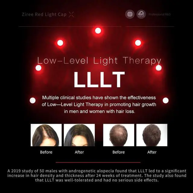 Alt view image 3 of 7 - FDA Cleared 650nm LLLT Laser Hair Growth Cap, 98 Diodes Red Light Therapy Cap