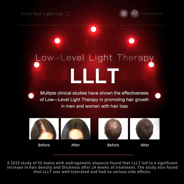 Alt view image 3 of 6 - FDA Cleared 172-Diode LLLT Laser Hair Growth Cap, 650nm Low Level Laser Therapy