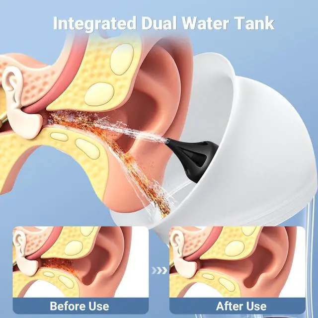 Alt view image 5 of 7 - Electric Ear Cleaner w/Water Temperature Sensor, Ear Cleaning Kit, Earwax Removal Tool w/ 4 Pressure Modes, IPX6 Ear Irrigation Flushing Kit, One-Piece Tank, Blue