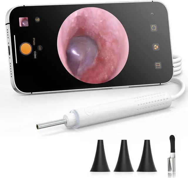 Main image of Otoscope with Light, 720P HD Ear Cleaning Camera & 6 LED Lights Ear Scope, Digital Otoscope with Camera, Smart Endoscope, Plug & Play, USB-C Port
