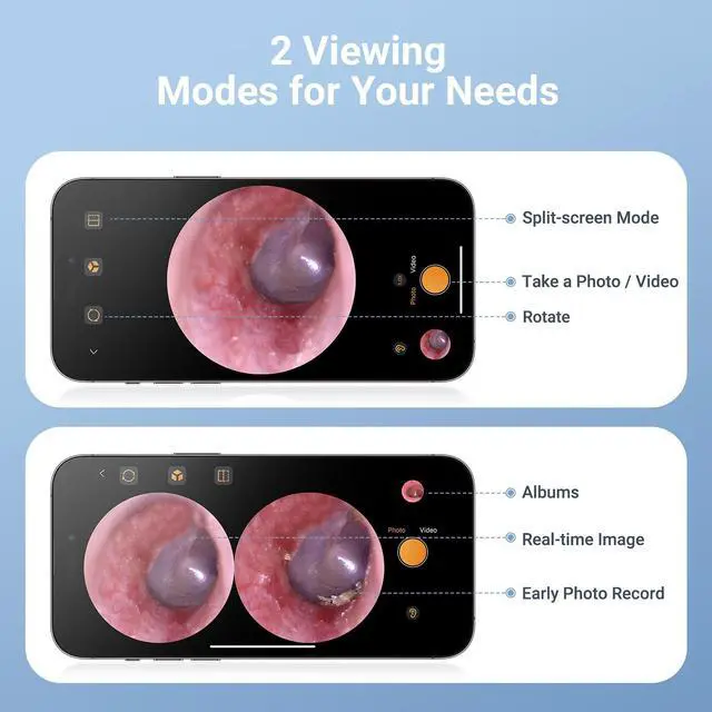Alt view image 5 of 5 - Otoscope with Light, 720P HD Ear Cleaning Camera & 6 LED Lights Ear Scope, Digital Otoscope with Camera, Smart Endoscope, Plug & Play, USB-C Port