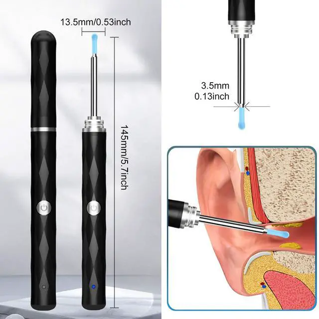 Alt view image 4 of 7 - High-Definition Ear Wax Removal Ear Canal Cleaner with 1080P Camera and Light, Ear Cleaning Kit with 5 Ear Spoon - Ear Cleaning Kit for iOS & Android (Black)
