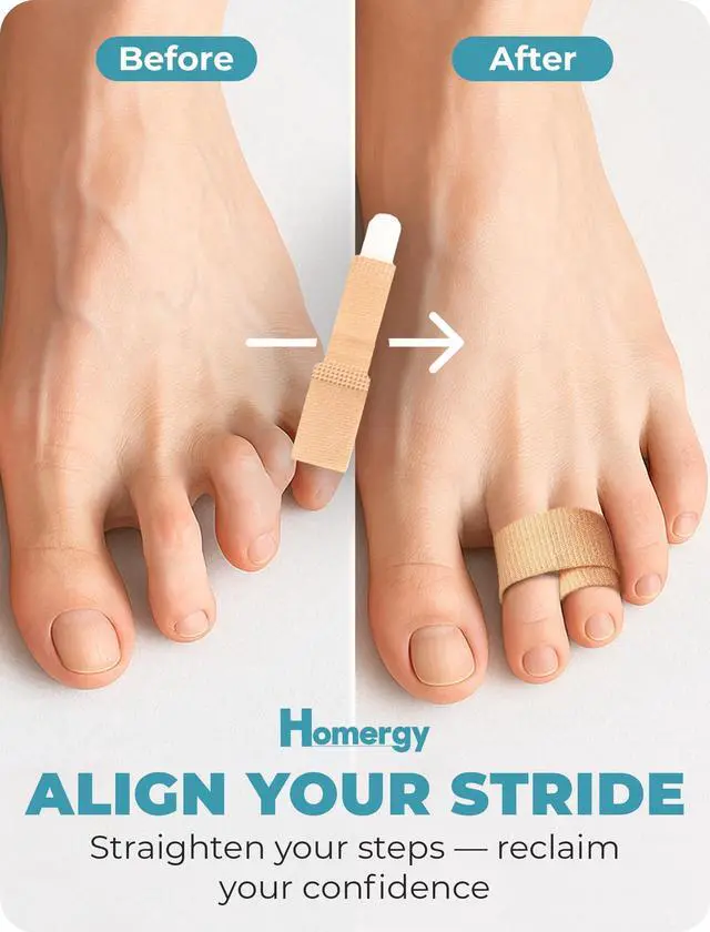 Alt view image 6 of 7 - Hammer Toe Corrector for Men & Women 4-Pack Reusable Toe Wraps & Tape for Broken, Bent & Overlapping Toes Soft Double-Layer Fabric Splints for Pain Relief & Alignment