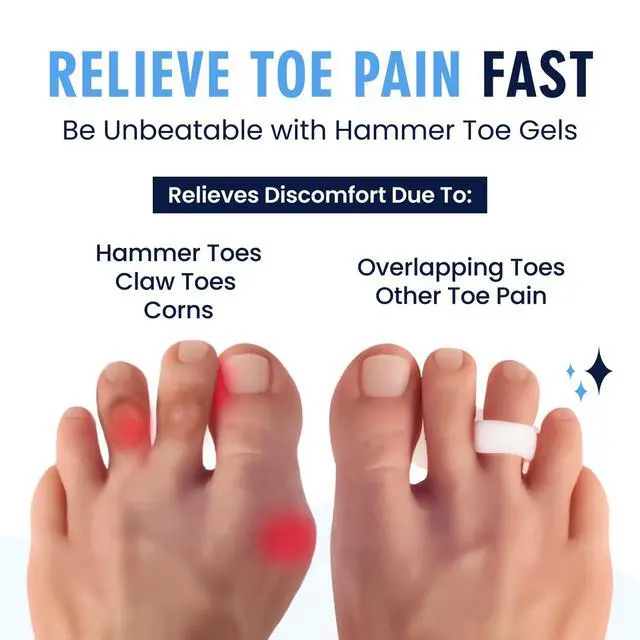 Alt view image 2 of 7 - Hammer Toe Corrector Gels - 2 Pairs - All-Day Relief for Crooked & Overlapping Toes - Soft Cushioning - Symptomatic Support for Toe Alignment - White - 1 Loop Design