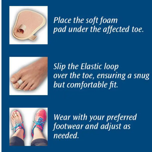 Alt view image 3 of 5 - Toe Straightener #P55