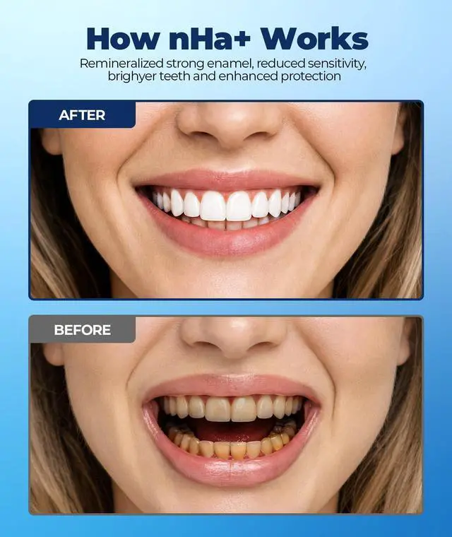 Alt view image 2 of 7 - 7.5% Nano Hydroxyapatite Toothpaste for Enamel Repair & Sensitive Teeth, Fluoride-Free Remineralizing Formula with Natural Mint, Gentle Oral Care for Daily Protection 1 Tube