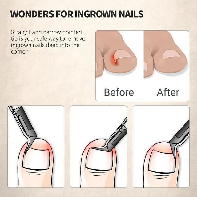 Alt view image 3 of 7 - Toenail Clipper Straight Blade for Ingrown and Thick Nails - Stainless Steel and Sharp Pointed Tip Ingrown Nail Clipper Wide Jaw Toe Nail Cutter Podiatry Tool Dark Gray