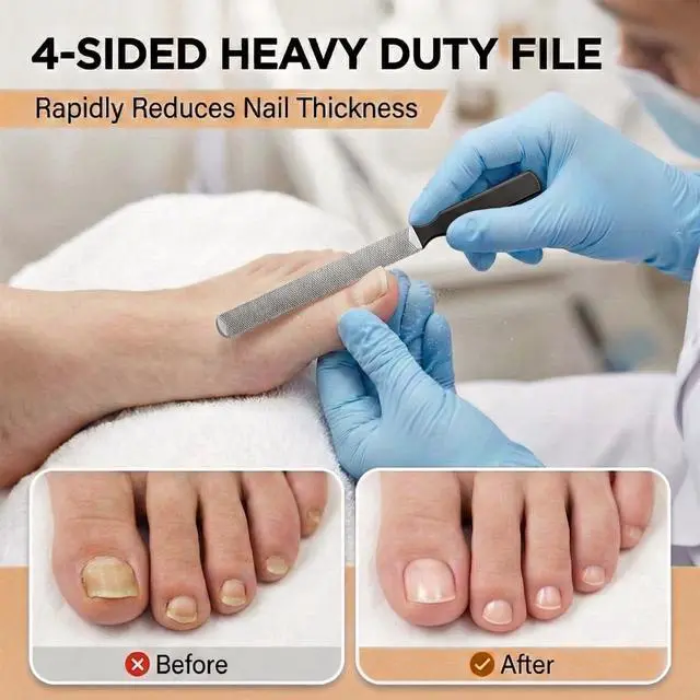 Alt view image 5 of 7 - Toenail Clippers for Thick Nails for Seniors, Heavy Duty Pedicure Kit with Metal Foot File & Ingrown Lifter, 3Pcs Professional Black Stainless Steel Grooming Set for Men