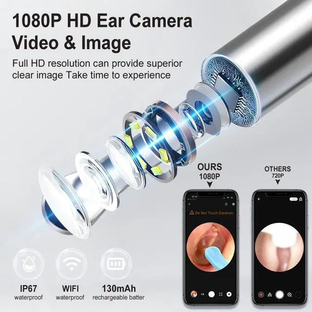 Alt view image 3 of 7 - Wireless WiFi Visual Ear Cleaner HD Smart Earwax Removal Kit with Rechargeable Illuminated Ear Pick, Complete Set for Safe & Precise Cleaning