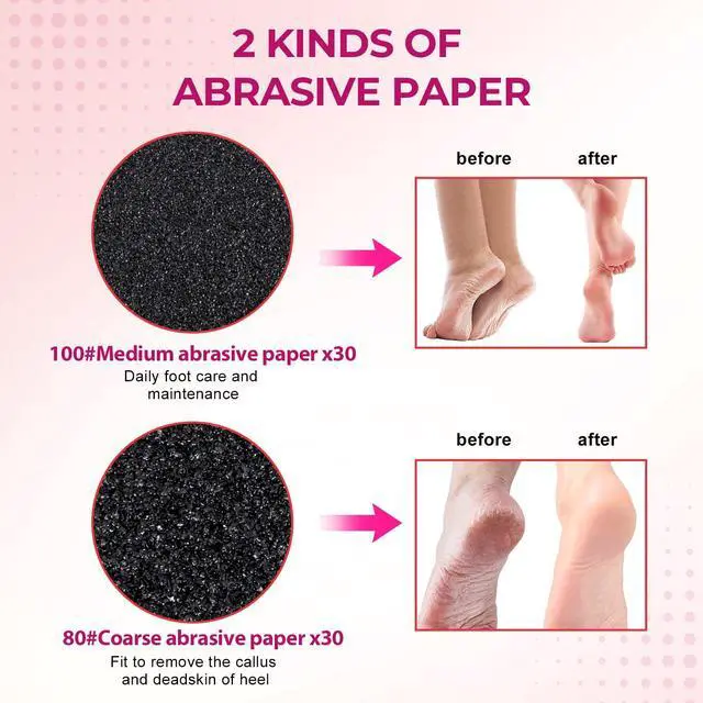 Alt view image 3 of 7 - 60 PCS Replaceable Sandpaper Discs - 80 & 100 Grit Pad Refills for Electric Foot File Callus Remover - Dead Skin and Calluses Removal