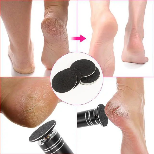 Alt view image 6 of 7 - 60 PCS Replaceable Sandpaper Discs - 80 & 100 Grit Pad Refills for Electric Foot File Callus Remover - Dead Skin and Calluses Removal