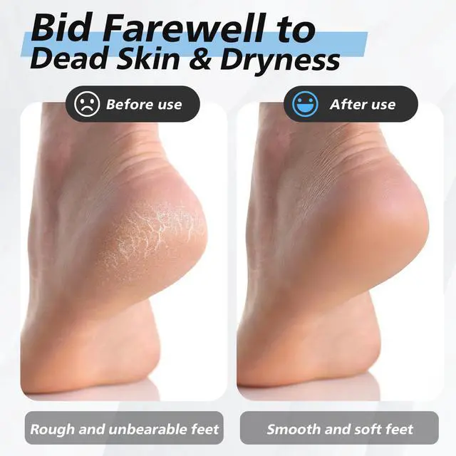 Alt view image 4 of 7 - Nano Glass Foot File Callus Remover for Feet - Glass Foot Scraper Scrubber Dead Skin Removal for Cracked Heels,Professional Pedicure Tool for Home, Salon, and Travel (Blue)