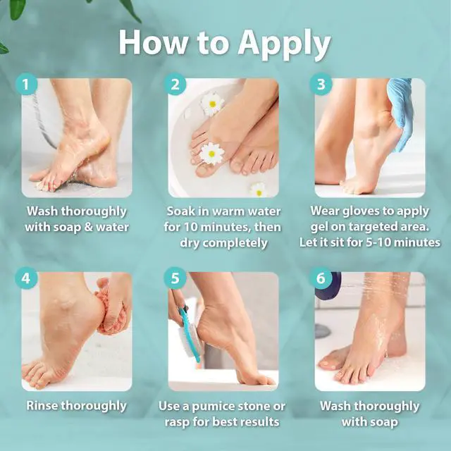 Alt view image 6 of 7 - Professional Callus Remover for Feet with 20% Urea, Epsom Salt, Salicylic Acid, Glycolic Acid, Heel Toe Foot Callus Remover Gel Peel Exfoliator Dead Skin Removal for Feet, Cracked Heel Repair