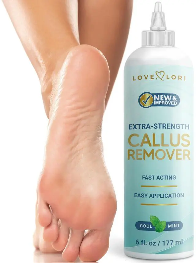 Main image of Feet (Extra Strength) Foot Callus Remover Gel - Pedicure Tools for Feet Scrubber Foot Care Spa Essentials, 6oz
