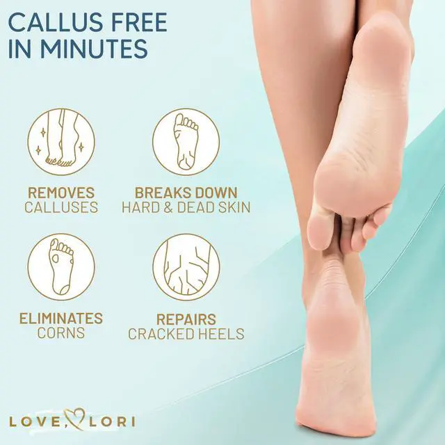 Alt view image 5 of 7 - Feet (Extra Strength) Foot Callus Remover Gel - Pedicure Tools for Feet Scrubber Foot Care Spa Essentials, 6oz