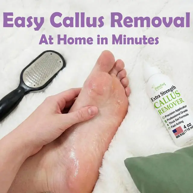 Alt view image 5 of 7 - Dr. Entre's Callus Remover Gel & Foot File: Extra Strength Callus Remover for Feet, Foot Callus Remover Care, Pedicure Tools Supplies, Spa Kit, Dead Skin Scrubber, 4 oz