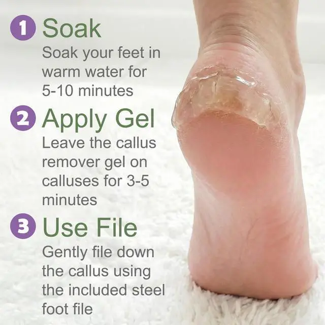 Alt view image 6 of 7 - Dr. Entre's Callus Remover Gel & Foot File: Extra Strength Callus Remover for Feet, Foot Callus Remover Care, Pedicure Tools Supplies, Spa Kit, Dead Skin Scrubber, 4 oz