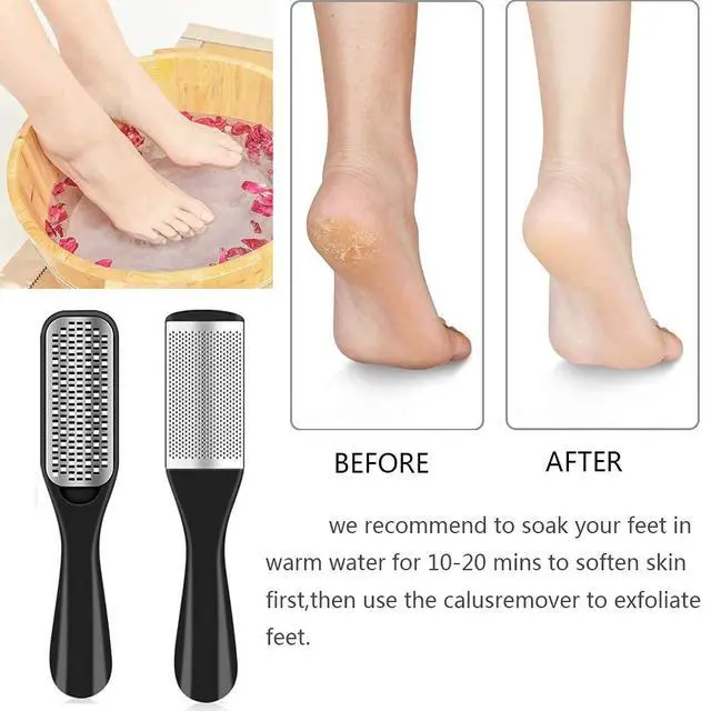Alt view image 4 of 7 - 36 in 1 Pedicure Kit, Professional Pedicure Tools Foot Rasp Foot Dead Skin Remover for Home & Salon Care