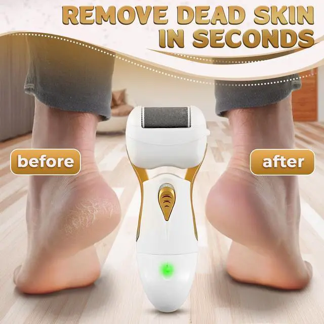 Alt view image 6 of 7 - Electric Callus Remover for Feet Electric Foot Filer with 3 Replacement Rollers & 360° Rotating Head Hard Skin Remover for Feet with Ergonomic Handle for Easy Grip & Control in Home Pedicure