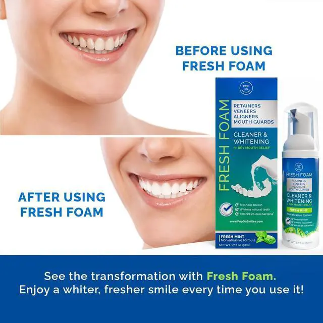 Alt view image 5 of 7 - Foam for Invisalign, Aligner Cleaner Whitening Foam for Mouth Guard Night Guard Veneers, Whitens Teeth, Freshens & Fights Bad Breath, 3% Hydrogen Peroxide, Mint - 50ml