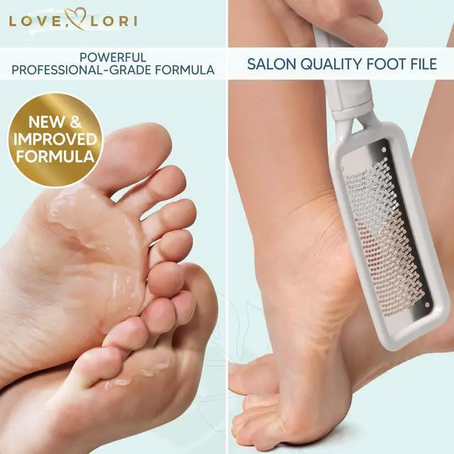 Alt view image 2 of 7 - Remover Kit - Foot File & Callus Gel Feet Scrubber Dead Skin Scraper Bundle, 6oz