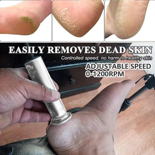 Alt view image 3 of 7 - Upgraded Electric Callus Remover for Feet 1200rpm, Adjustable Speed Professional Electric Foot File Pedicure Foot Sander with 60 Replaceable Sandpaper Discs for Heel Dead Skin, Silver