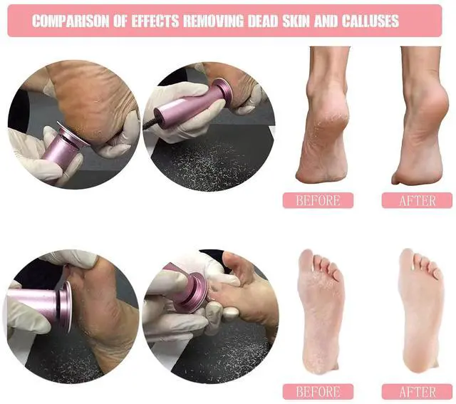 Alt view image 2 of 7 - Electric Foot File Callus Remover Professional Foot File Pedicure Tools Adjustable Speed 60pcs Replacement Sandpaper disc Easy to Remove Cutin Dead Skin calluses(black 60pcs)