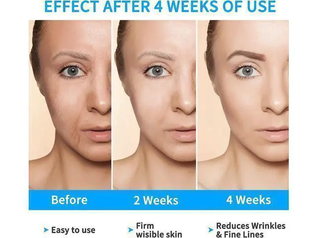 Alt view image 3 of 6 - Face Lift, Electric V Face Shaping Massager, V Face Beauty Device