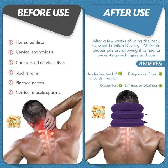 Alt view image 6 of 7 - Neck Stretcher for Neck Pain Relief, Cervical Traction Device, Neck Traction Device, Adjustable Inflatable Neck Brace & Cervical Neck Traction Device Home Use Decompression(Purple)