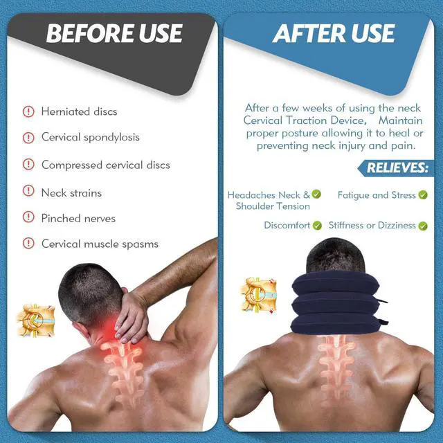 Alt view image 3 of 7 - Neck Stretcher, Neck Traction Device, Cervical Traction Device, Neck Pain Relief, Adjustable Inflatable Neck Brace & Neck Stretcher Cervical Traction, Neck Decompression Home Use (Blue)