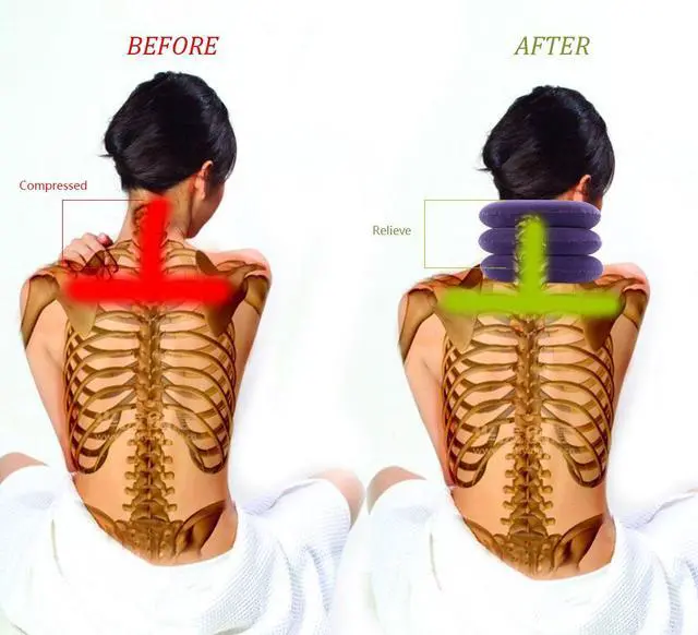 Alt view image 3 of 7 - Cervical Neck Traction Device Inflatable Neck Stretcher, Easy to Use for Chronic Neck and Shoulder Pain Relief Traction Spine Alignment, Neck Cervical BracePurple