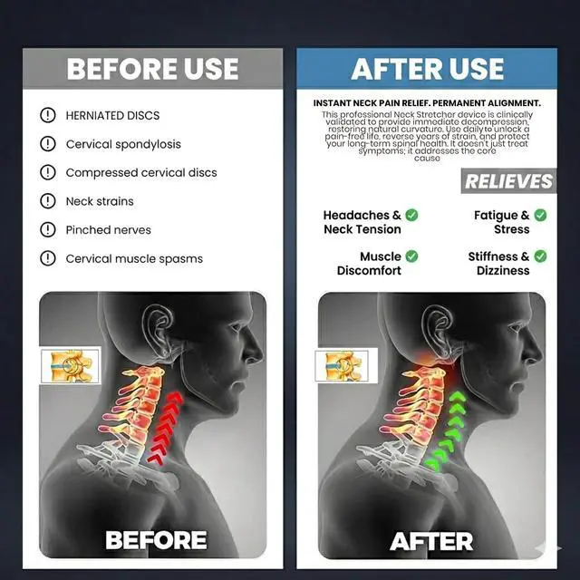Alt view image 6 of 7 - Neck Stretcher, Cervical Traction Device, Neck Traction Device for Neck Pain Relief, Adjustable Inflatable Neck Stretcher Cervical Traction and Neck Brace, Neck Decompression Home Use (Gray)